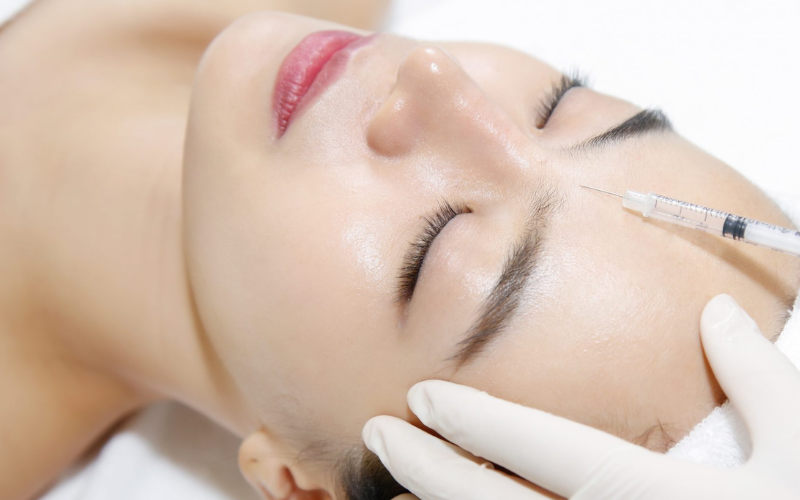 Mesotherapy là gì? Giải mã bí quyết trẻ hóa da không phẫu thuật "hot" nhất hiện nay