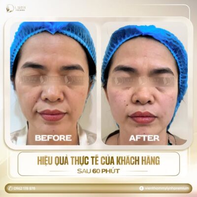 572466901 122103503859082996 1231883912967764720 n