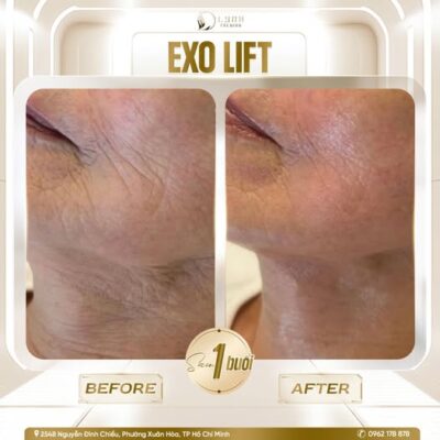 591309546 122109487671082996 4039932583868876467 n