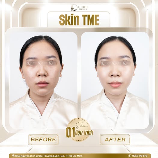 594072116 122149538570666828 7187875362368568483 n