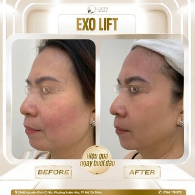 594078874 122109653307082996 6222976300863780904 n