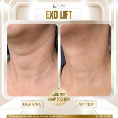 595065283 122110564095082996 4475384889121389490 n