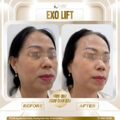 595241720 122110573713082996 6238537544765674018 n