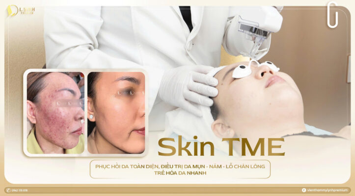 Skin TME điều trị trẻ hóa da toàn diện